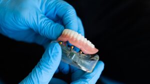 Scopri di più sull'articolo Quanto costa un impianto dentale?
